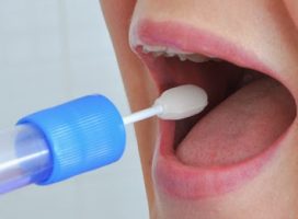 All that you should Learn About Saliva Drug Testing